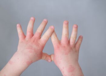 Çocuklar okullardaki bulaşıcı hastalıklardan nasıl korunmalı?