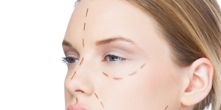Ameliyatsız yüz germe teknikleri neler?