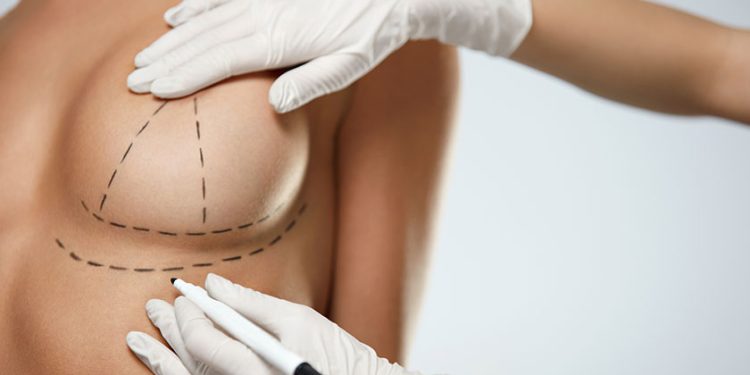 Onkoplastik meme cerrahisinin avantajları