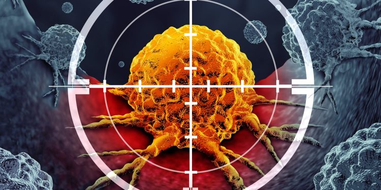 2040’ta Kanser Vakaları 30 Milyonu Bulabilir!