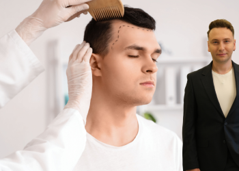 İngiltere Mahkemesinden Kritik Karar: İngilizler Saç Ekimi İçin Türkiye’ye Akın Edecek!