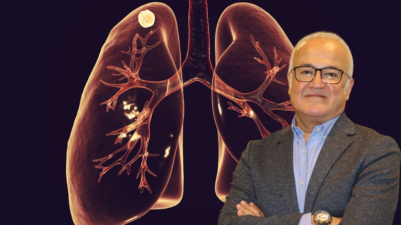 Akciğer Nodülleri Kansere Dönüşebilir mi? Uzmanından Kritik Uyarılar